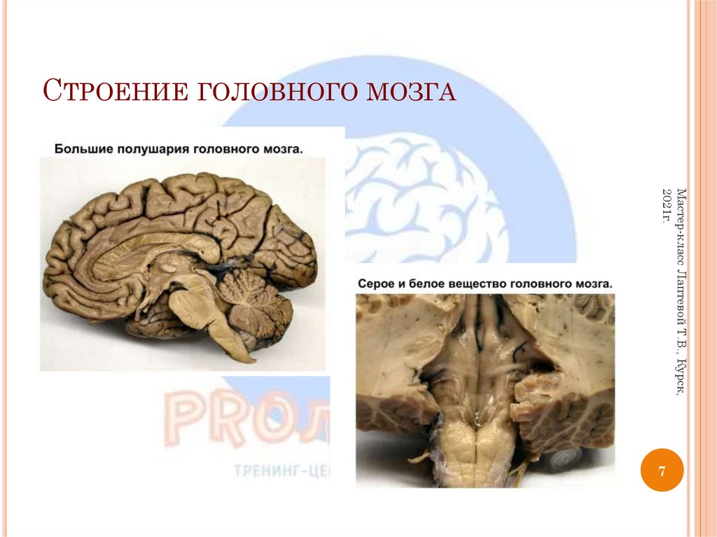 Строение головного мозга