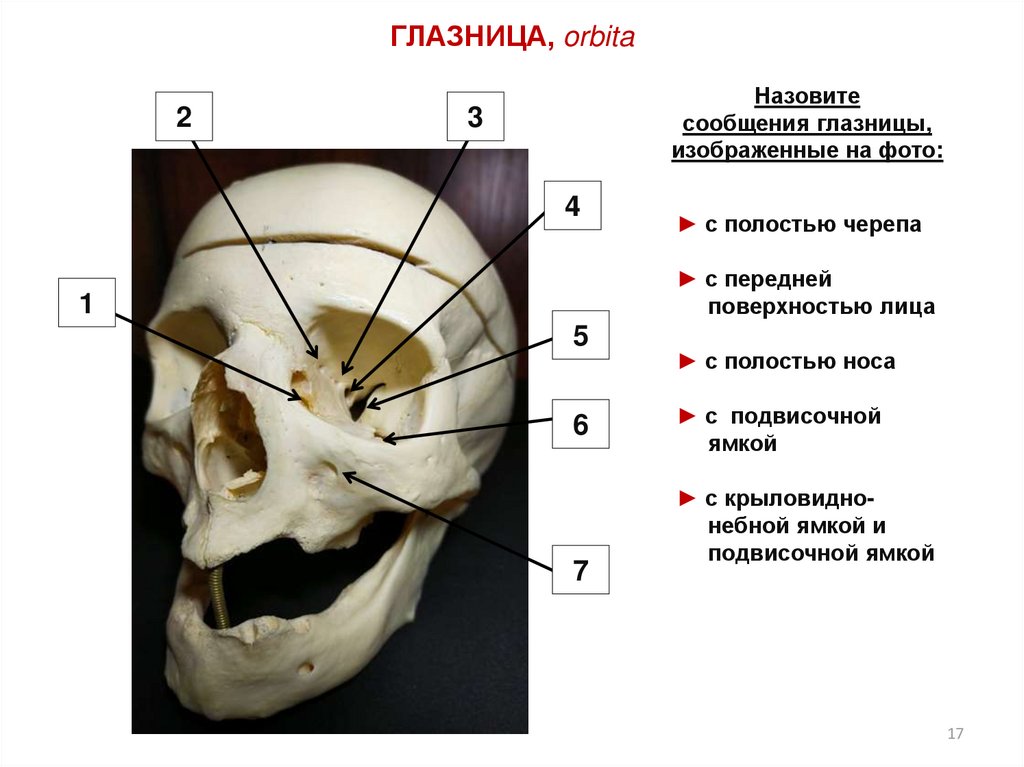 Клыковой ямки. Глазница черепа анатомия. Анатомия черепа кости глазницы. Глазница стенки глазницы.