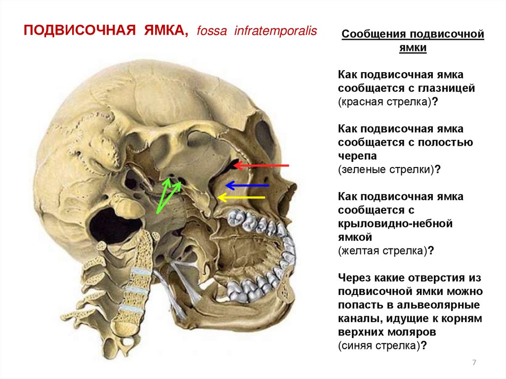 Крылонебная ямка сообщается. Височная ямка и подвисочная ямки. Височная ямка черепа стенки. Подвисочная ямка черепа. Подвисочная ямка кт.