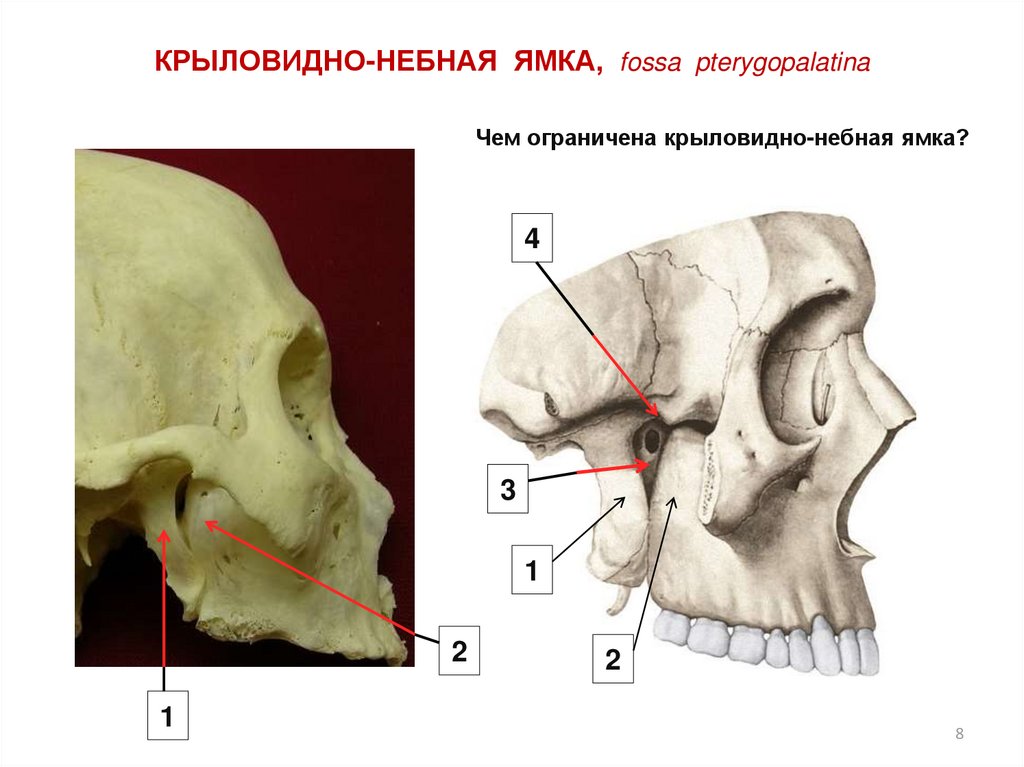 Медиальная стенки крыловидно небной ямки образована. Крыловидно-небная ямка(Fossa pterygopalatina). Крыловидно небная ямка анатомия. Fossa pterygopalatina на черепе. Крылонебная ямка на черепе.