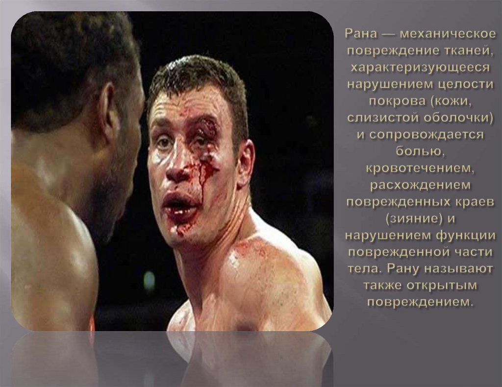 Рана — механическое повреждение тканей, характеризующееся нарушением целости покрова (кожи, слизистой оболочки) и