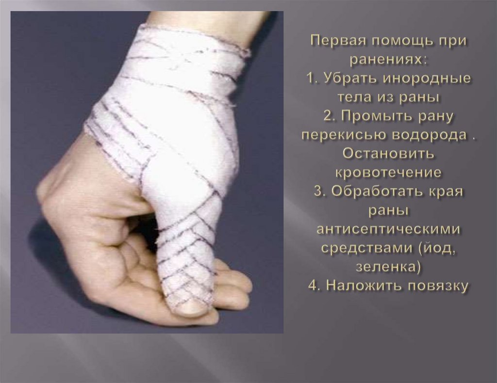 Первая помощь при ранениях: 1. Убрать инородные тела из раны 2. Промыть рану перекисью водорода . Остановить кровотечение 3.