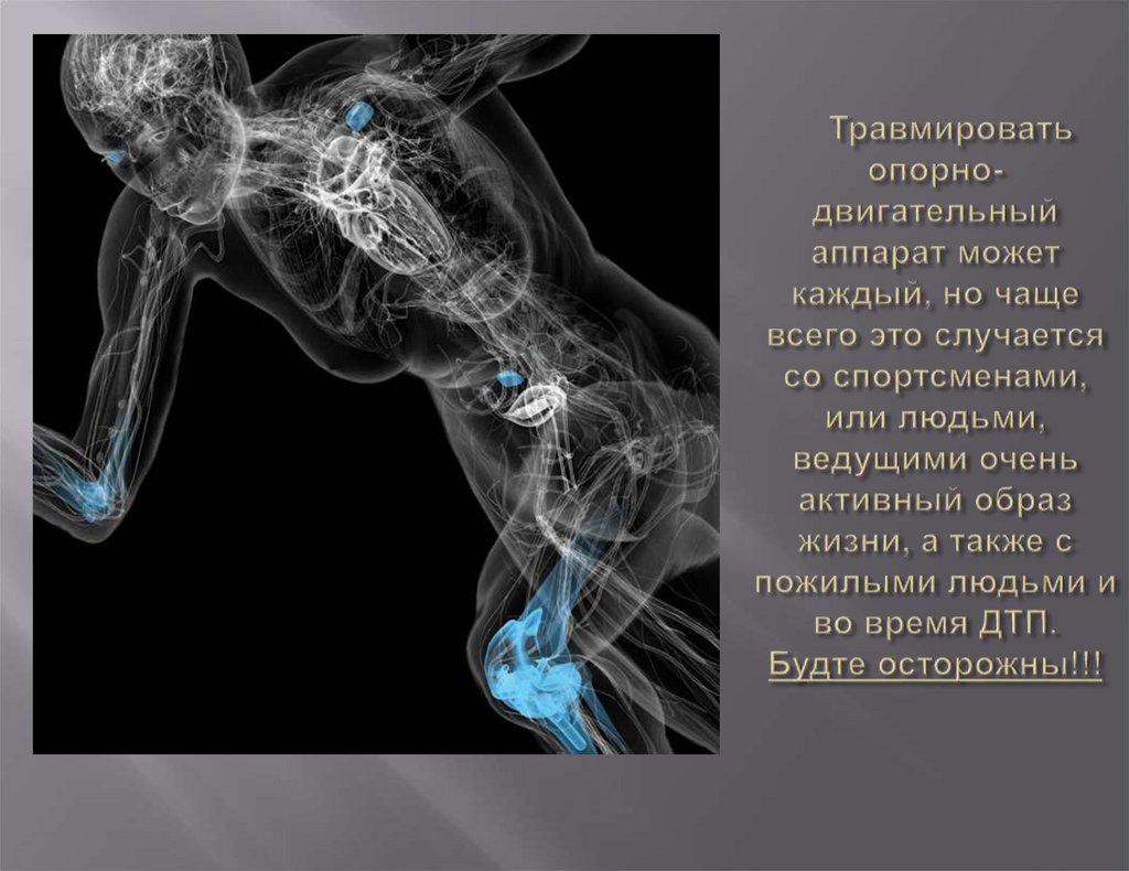 Травмировать опорно-двигательный аппарат может каждый, но чаще всего это случается со спортсменами, или людьми, ведущими очень
