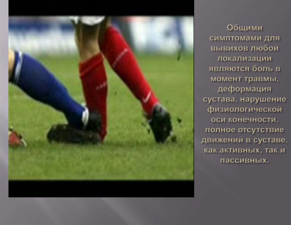 Общими симптомами для вывихов любой локализации являются боль в момент травмы, деформация сустава, нарушение физиологической