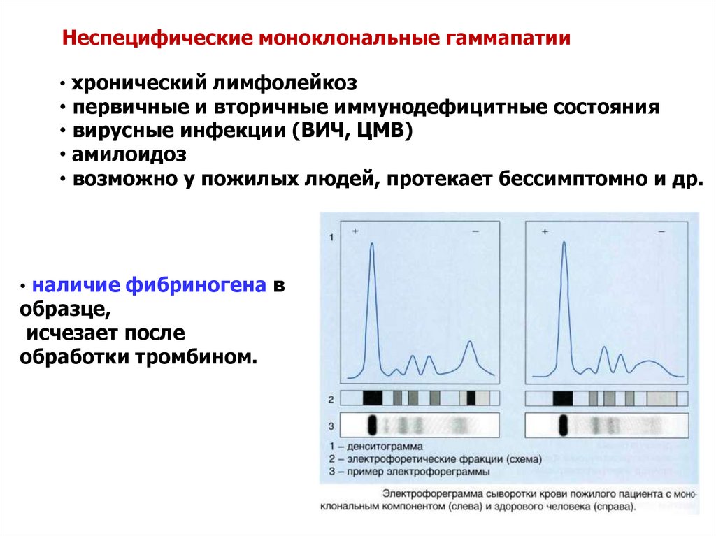 Нарушение белковых фракций