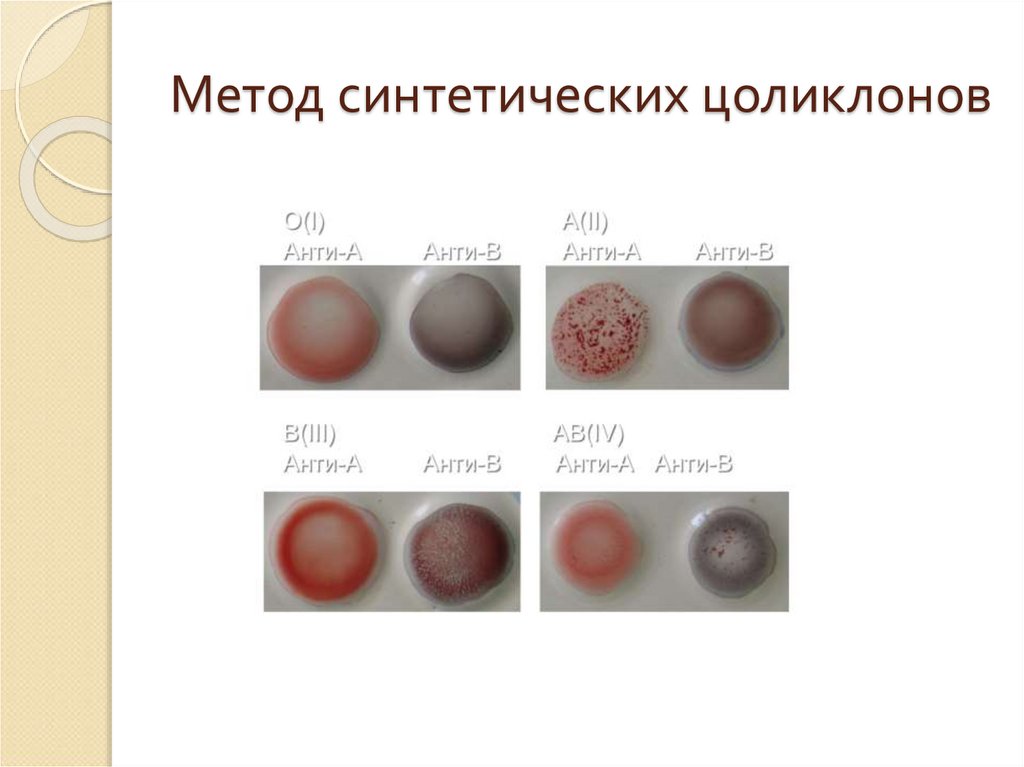 Цоликлоны определить группу. Метод цоликлонов. Цоликлоны для определения группы крови. Стандартные эритроциты. Группа крови цоликлонами.