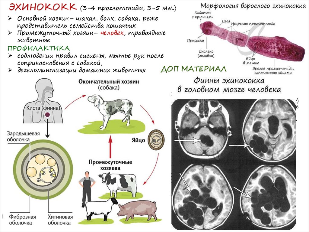 Эхинококк особенности