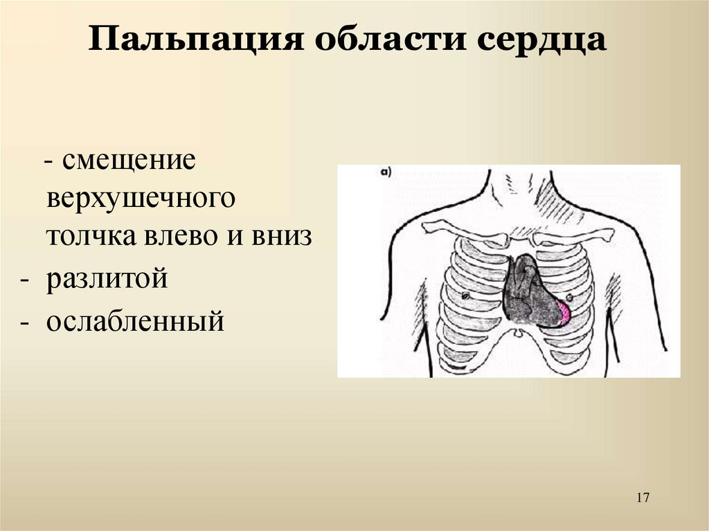 Пальпация сердца. Верхушечный толчок пропедевтика. Пальпация области сердца верхушечный толчок. Осмотр и пальпация области сердца верхушечный толчок. Пропальпировал верхушечный толчок.