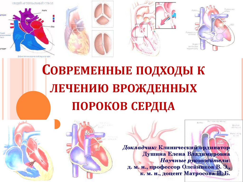 Презентация на тему пороки сердца