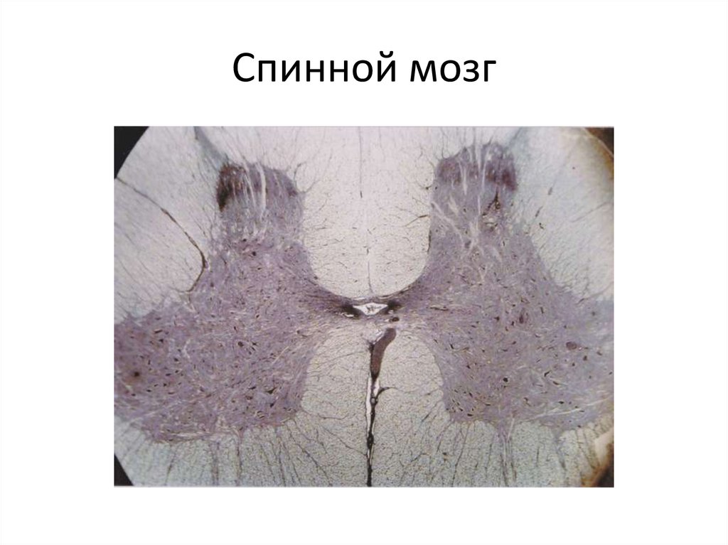 Артерия эластического типа рисунок