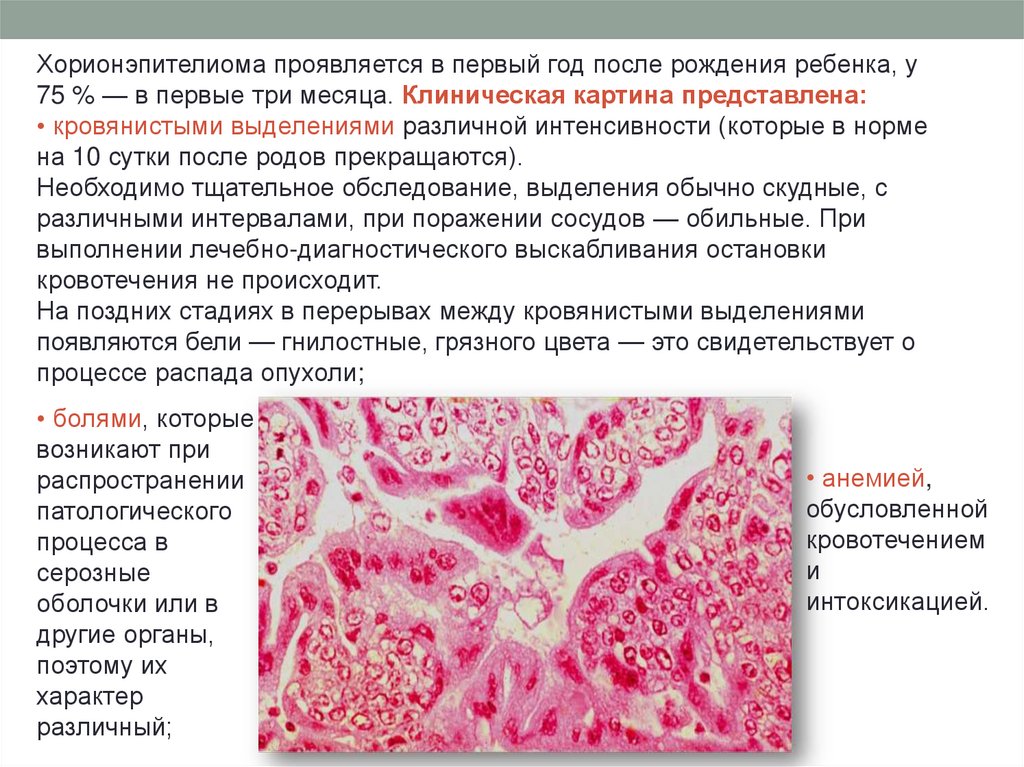 Хорионэпителиома - презентация онлайн