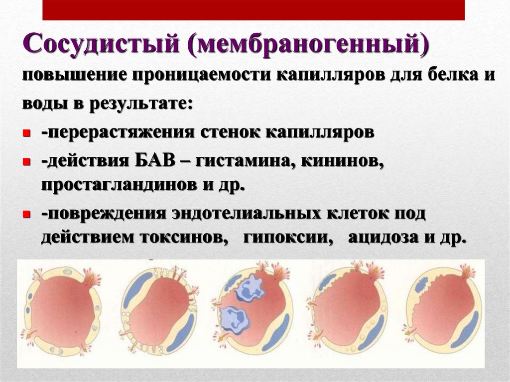 Увеличение сосуда. Повышение проницаемости капилляров. Повышенная проницаемость капилляров. Увеличение проницаемости сосудов. Сосудистый мембраногенный.