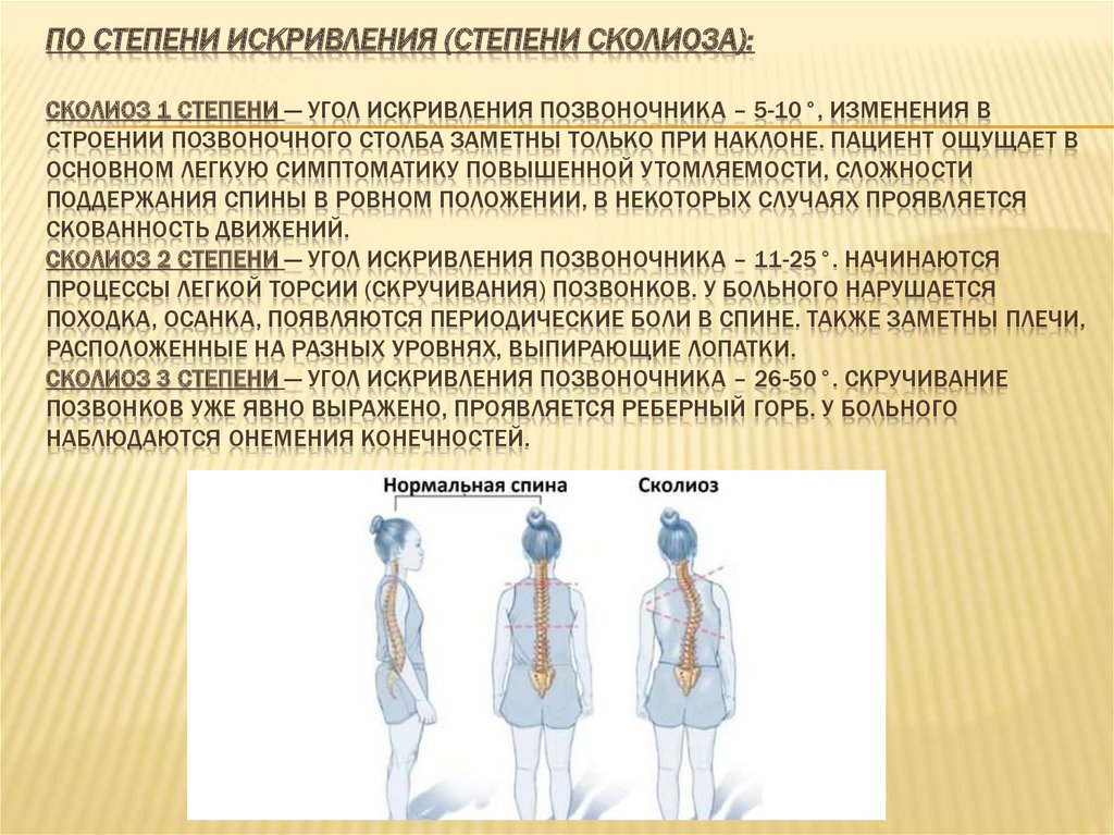 Задачи при сколиозе