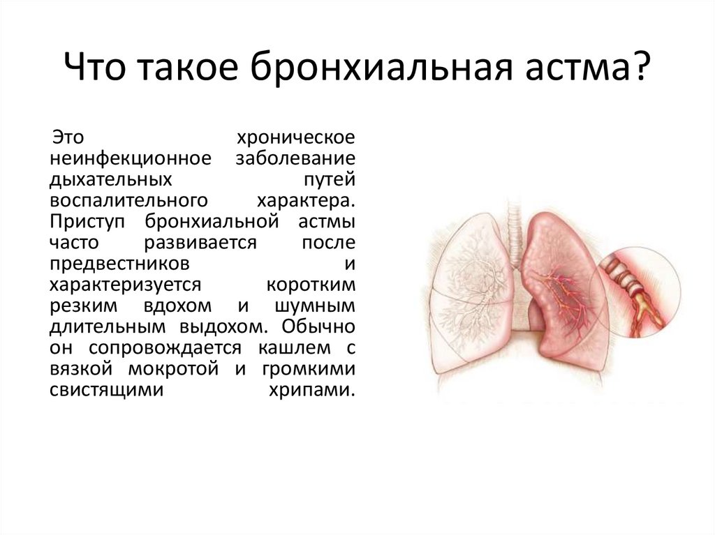 Реабилитация при бронхиальной астме презентация