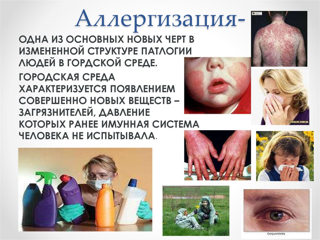 Аллергизация-