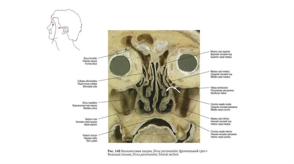 Фронтальный срез. Околоносовые пазухи анатомия. Ячейки решетчатого Лабиринта. Носовая полость фронтальный срез.