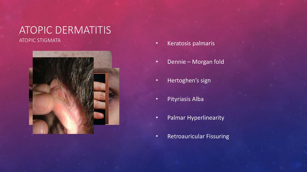 Dermatology Skin And Soft Tissue Infections Dermatitis презентация