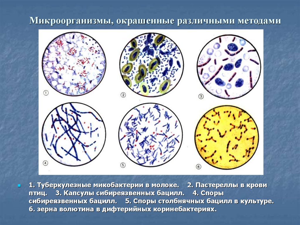 Методы микроорганизмов. Методы микробиологических исследований. Методы исследования микроорганизмов. Методы исследования микроорганизмов в микробиологии. Методы исследования бактерий микробиология.