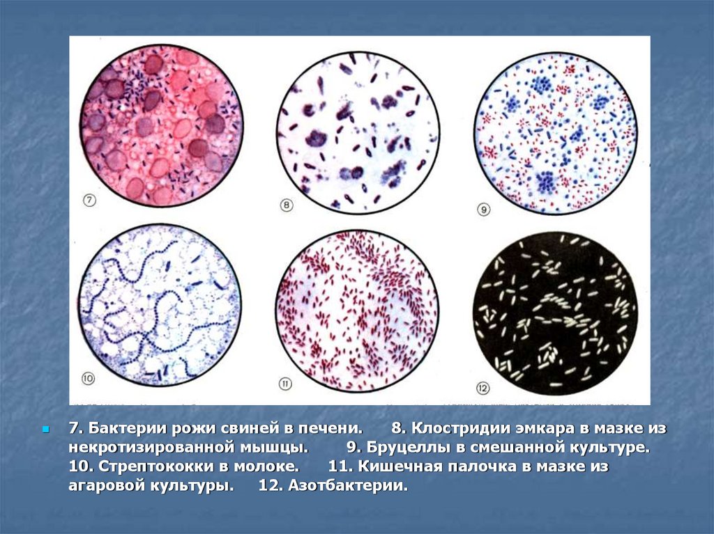 Микроскопическая картина u норма