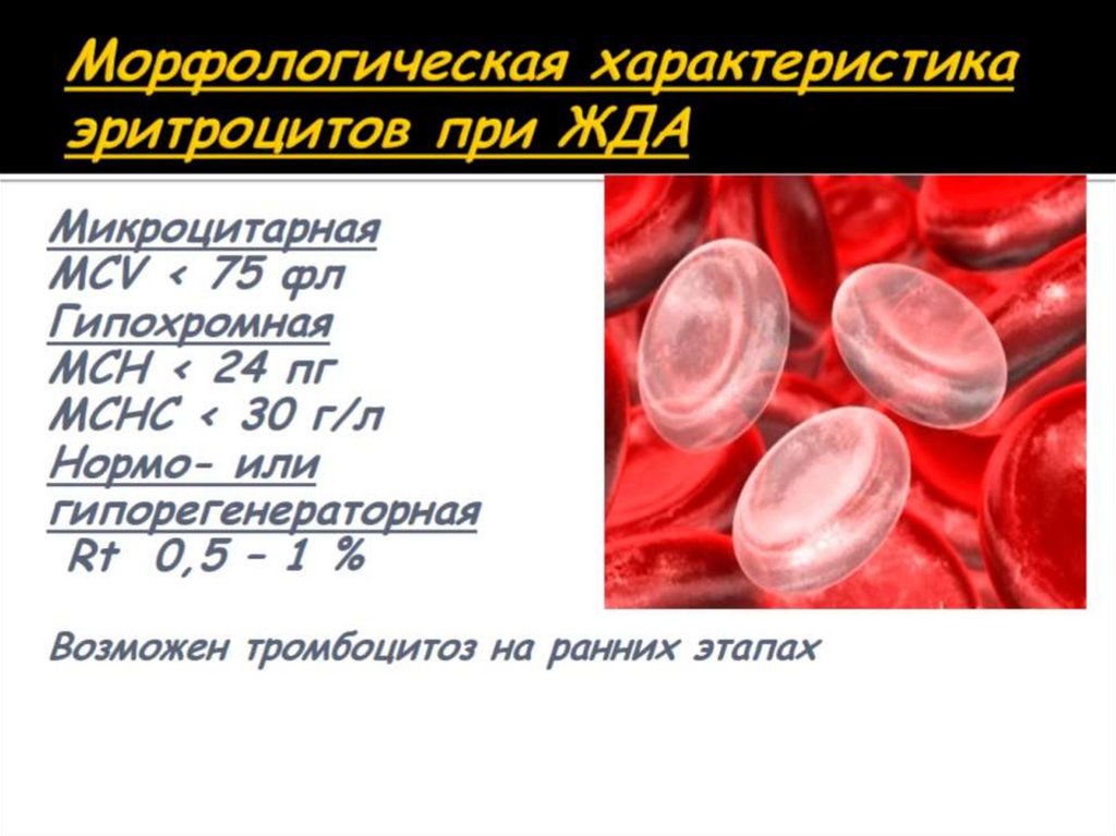 Морфологическая характеристика эритроцитов при ЖДА
