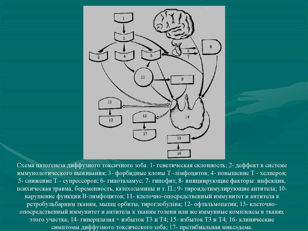 Патогенез дтз схема