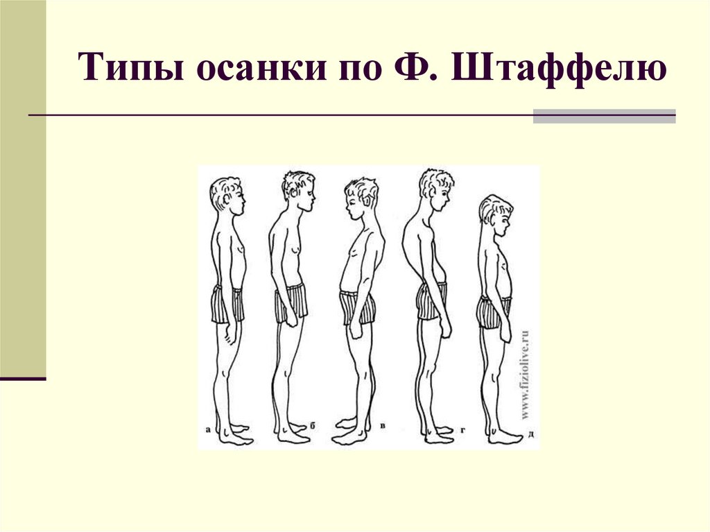 Как называется нарушение осанки изображенное на рисунке 2