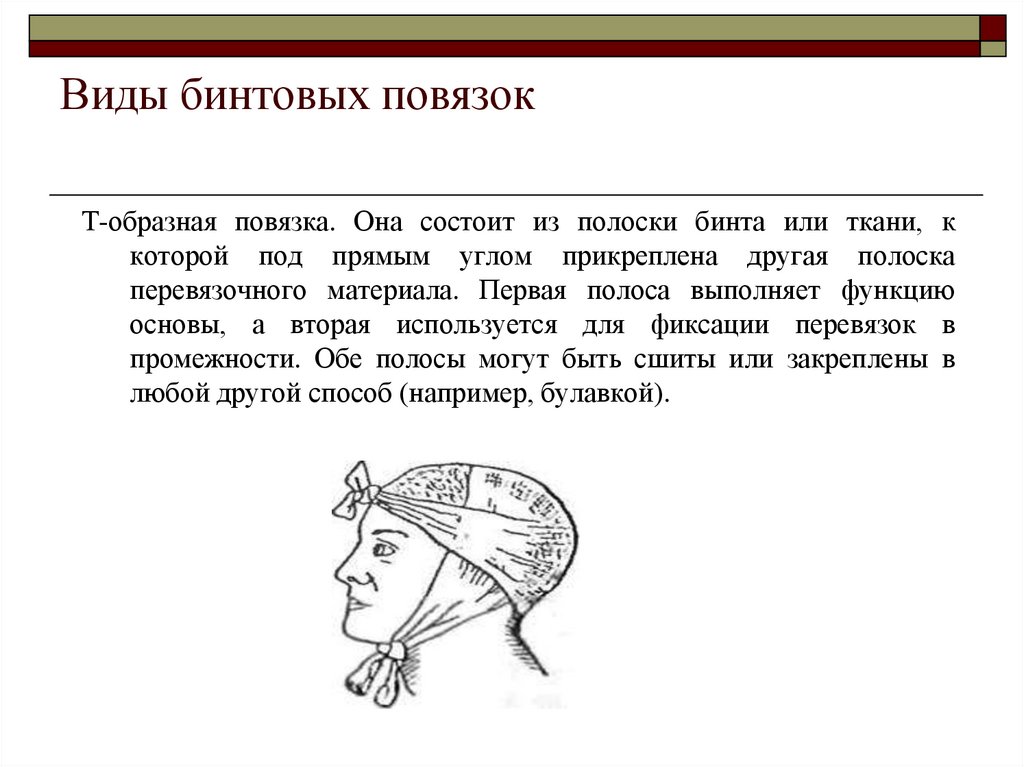 Посмотрите на рисунок 1 и подпишите типы бинтовых повязок