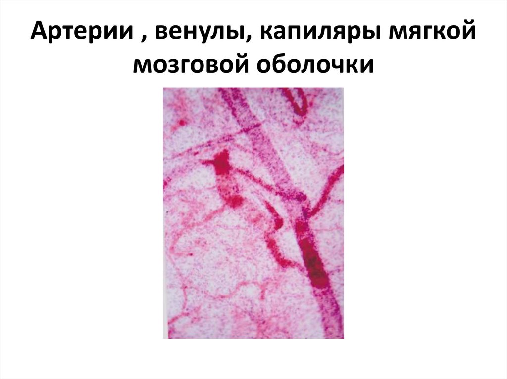 Мягкая мозговая оболочка ткань Мягкая мозговая оболочка ткань