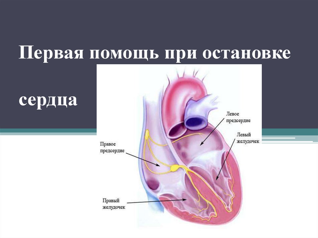 Презентация на тему первая помощь при остановке сердца