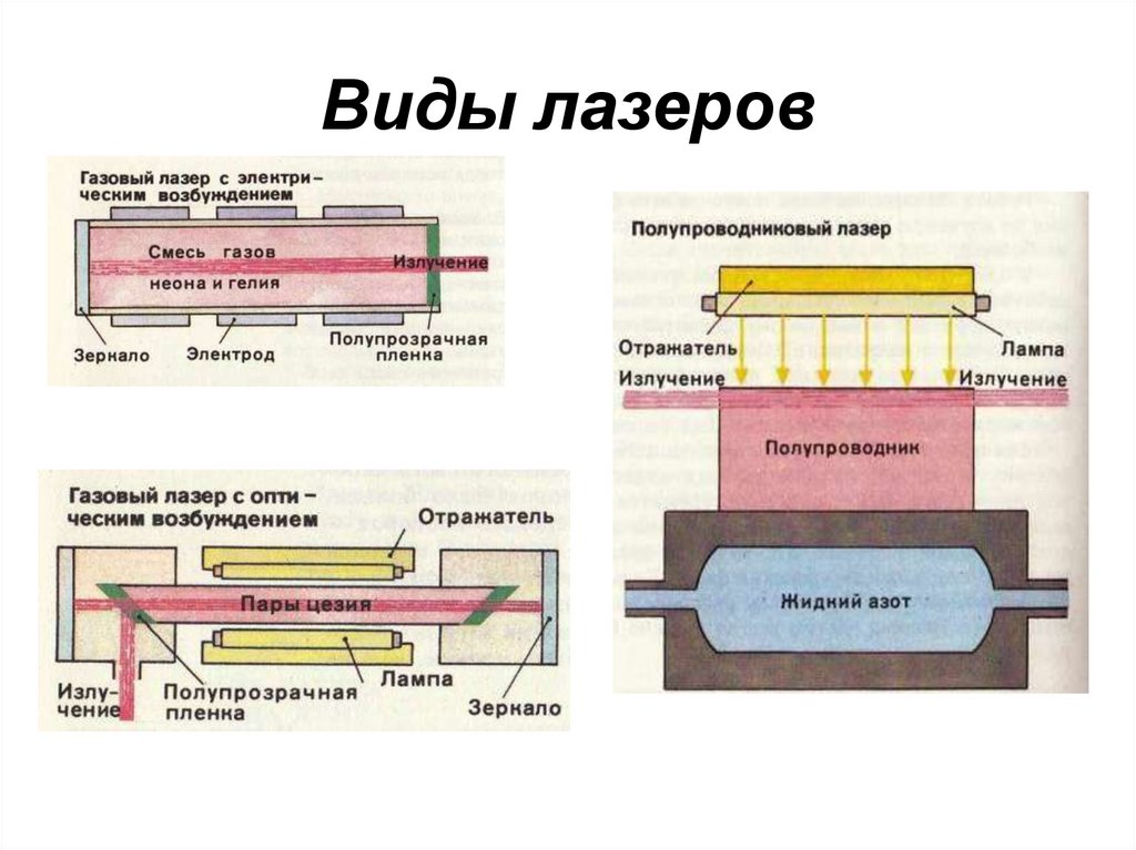 Лазерный тип
