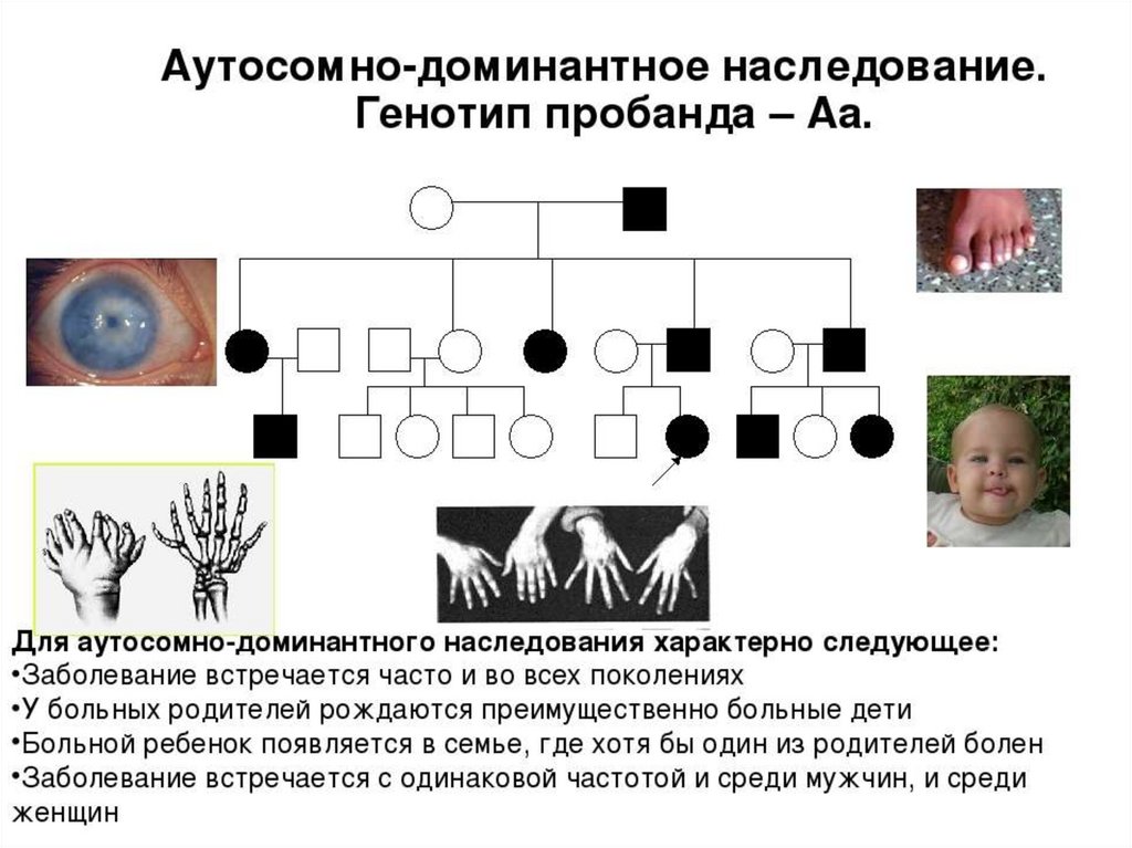 Аутосомно доминантный тип наследования. Генеалогический метод аутосомно доминантный. Аутосомно-доминантный Тип наследования генотип пробанда АА. Аутосомно-доминантный Тип наследования задачи с решением. Аутосомно рецессивный Тип наследования генотип пробанда.