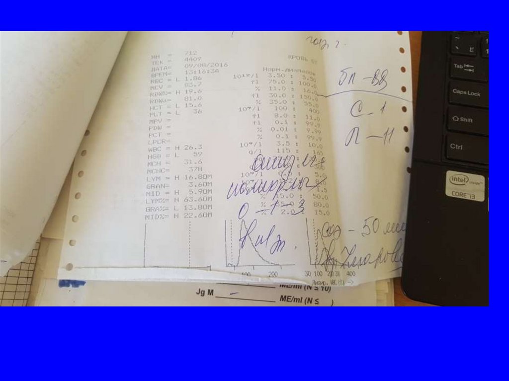 Взятие костного мозга