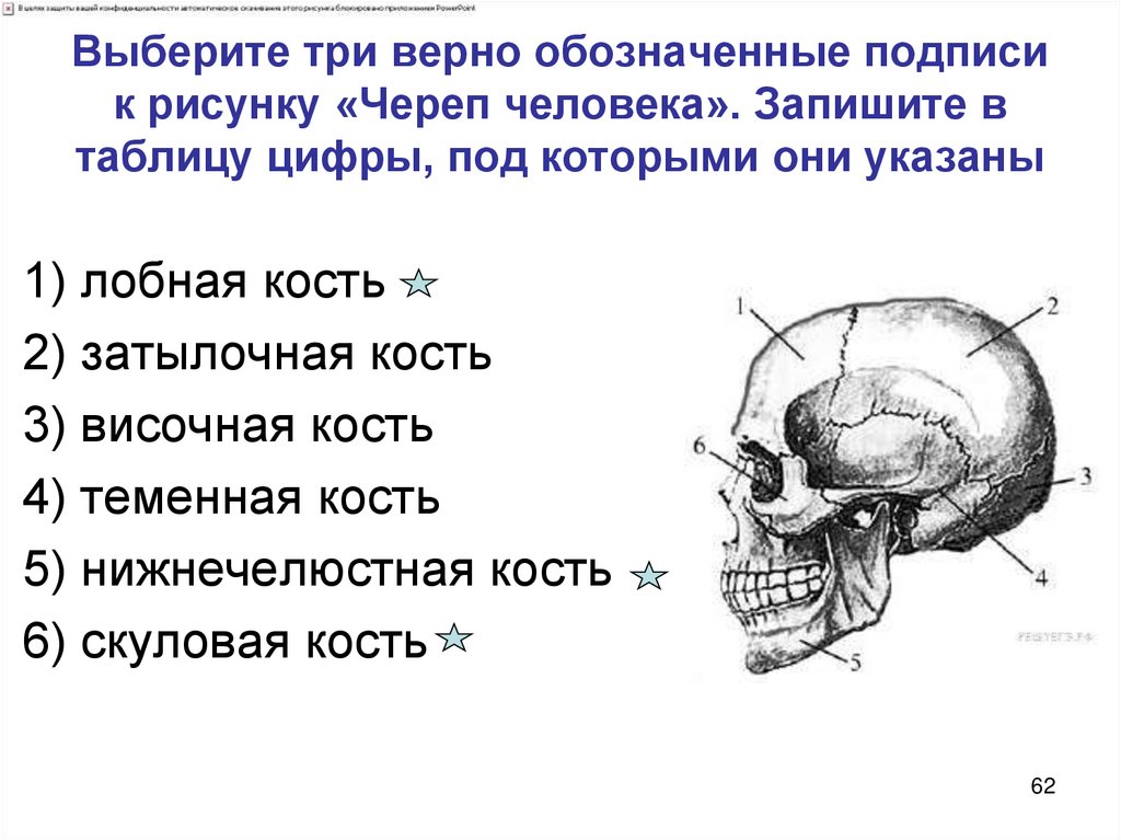 Выберите три верно обозначенные. Особенности строения черепа человека. Кости черепа человека рисунок с подписями. Обозначение подписи к рисунку череп человека. Затылочная и височная кости.