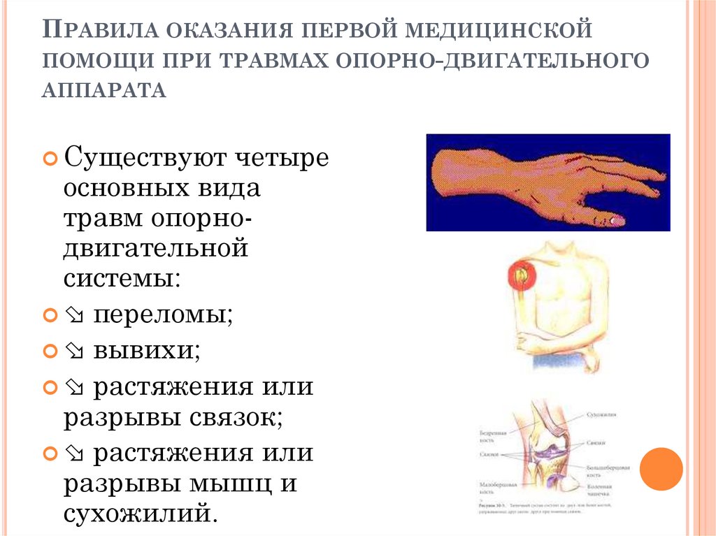 Травмы симптомы первая помощь