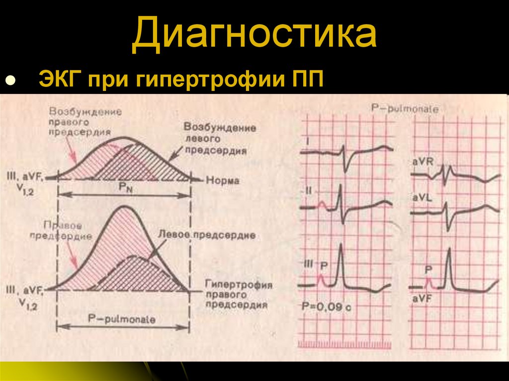 Диагностика