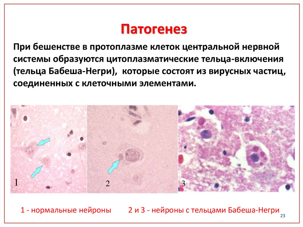 План ухода за пациентом при бешенстве ответ