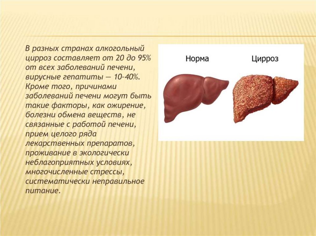 Поражение легких и печени. Токсический алкогольный цирроз печени. Этаноловый цирроз печени. Цирроз печени печени презентация.