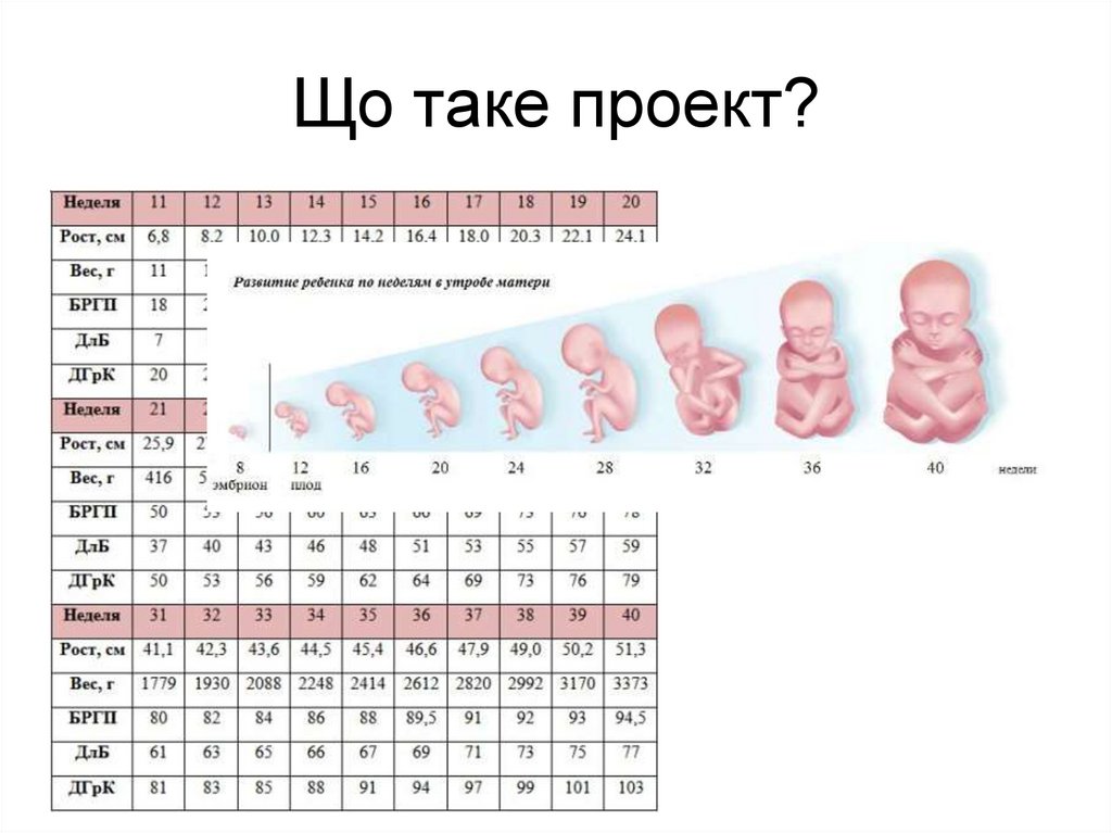 Що таке проект?
