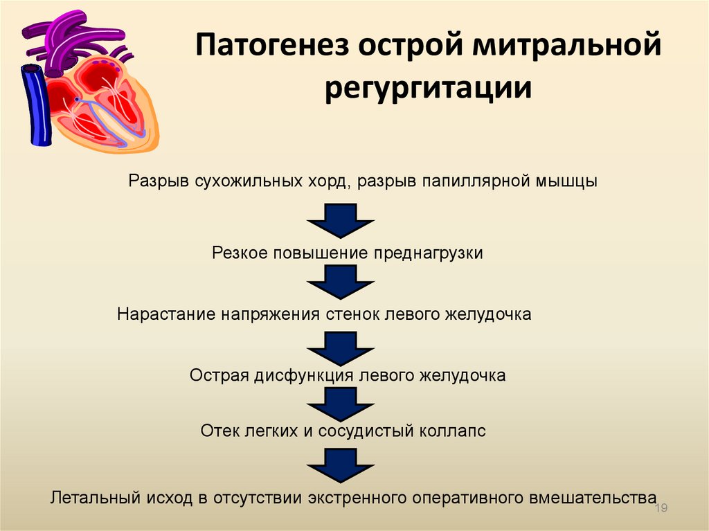 Патогенез митральной недостаточности схема