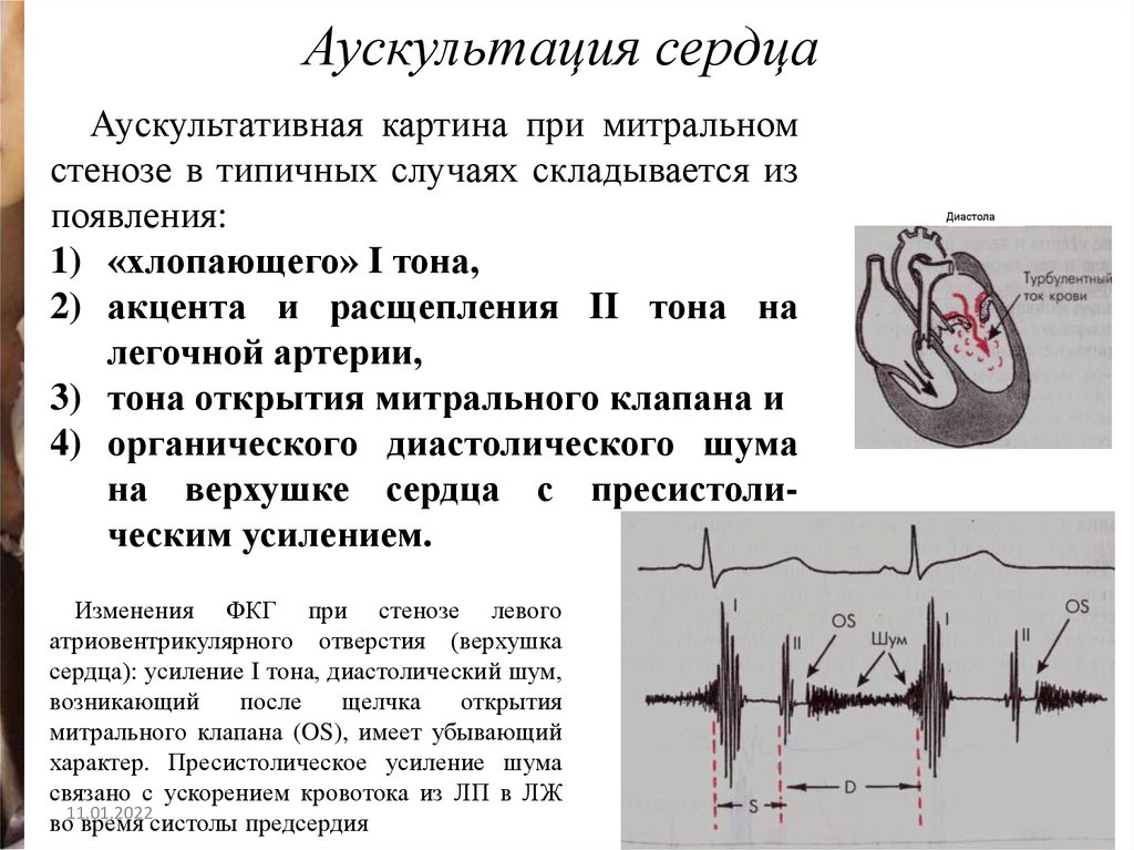 Сколько живут с пороком сердца приобретенным