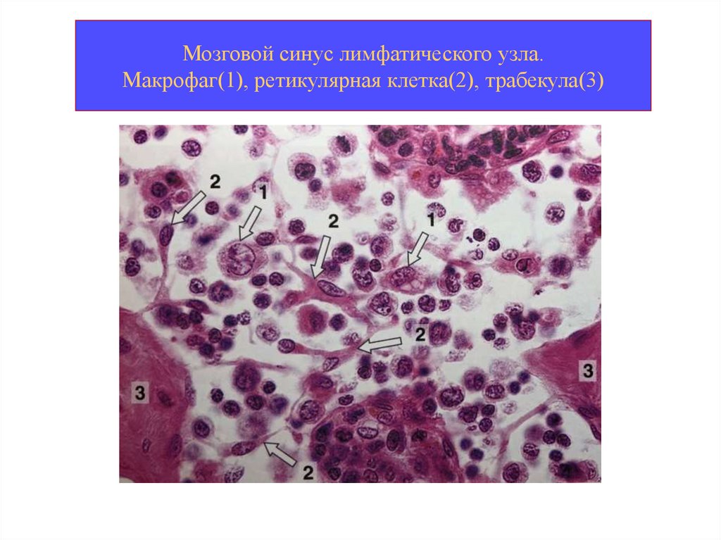 Макрофаги 1 3. Макрофаги лимфатических узлов. Ретикулярная ткань лимфатического узла. Органы кроветворения и иммунной защиты. Ретикулярные клетки.