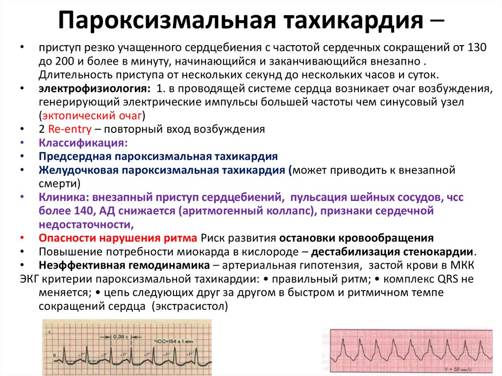 Пароксизмальная тахикардия презентация