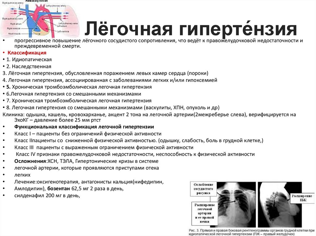 Тромбоэмболия легочной артерии пневмония