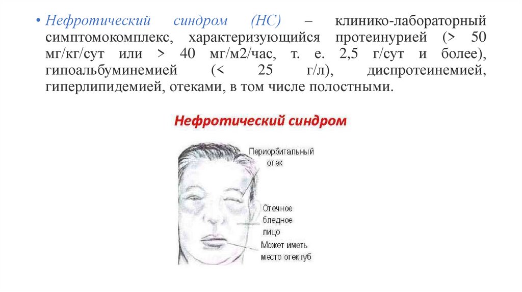 Сестринский уход при гломерулонефрите у детей