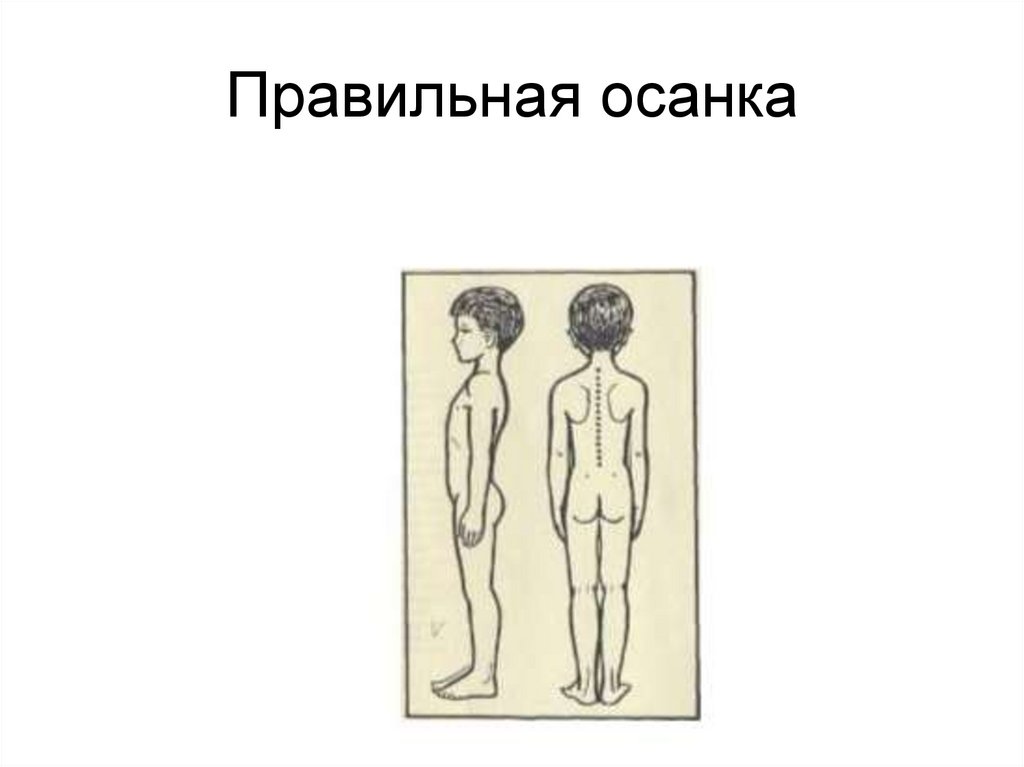 Правильная осанка
