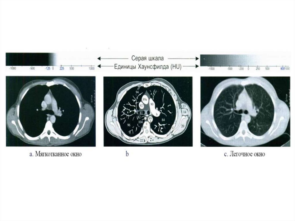 Шкала хаунсфилда презентация