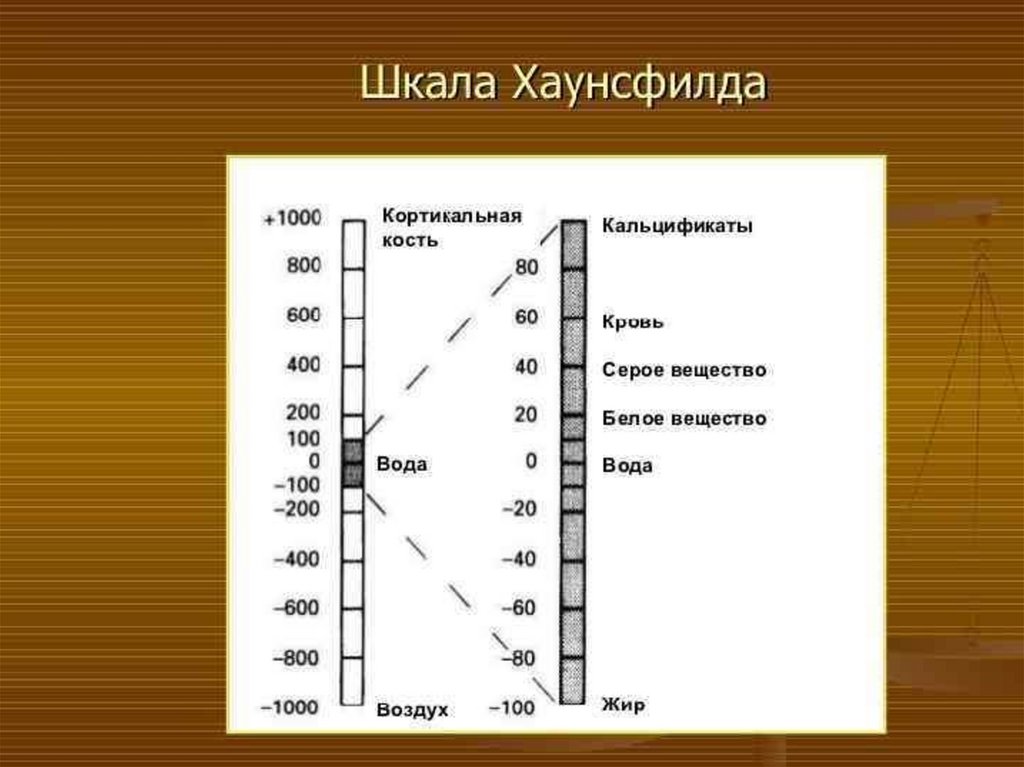 Шкала хаунсфилда презентация