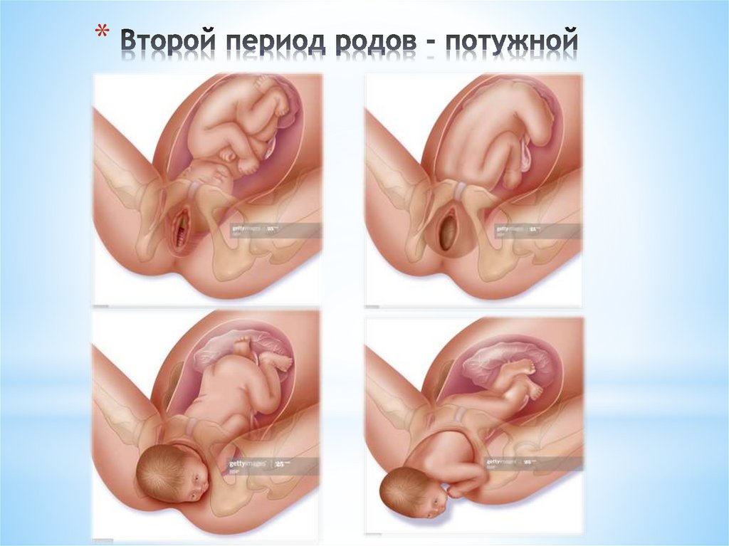 Второй период родов - потужной