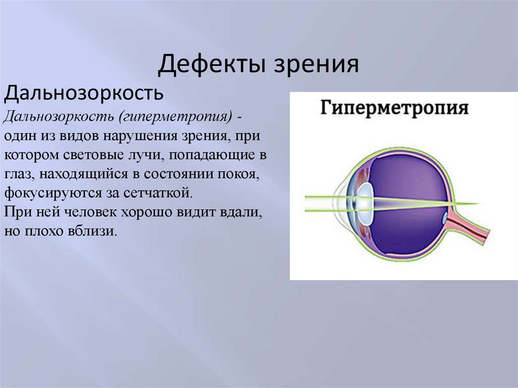 Сообщение по теме как сохранить зрение физика