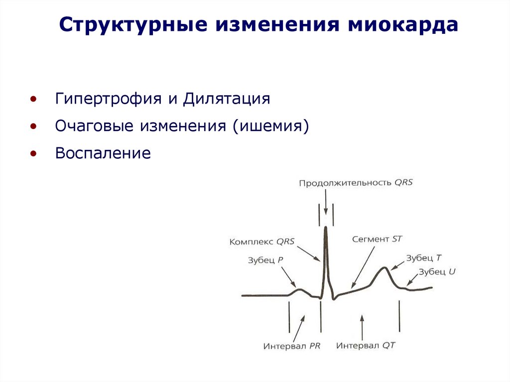 Изменение миокарда. Структурные изменения в миокарде. Очаговые изменения миокарда. Электрическая активность миокарда. Структурно функциональные изменения миокарда.